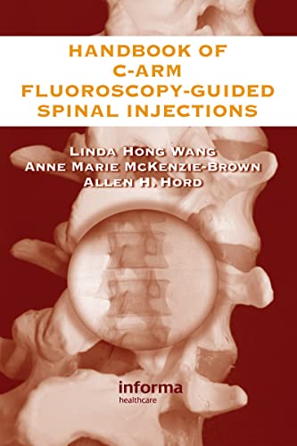 The Handbook of C-Arm Fluoroscopy-Guided Spinal Injections von CRC Press